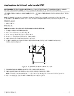 Предварительный просмотр 143 страницы Stryker Medical Ultra Comfort SE Operation Manual