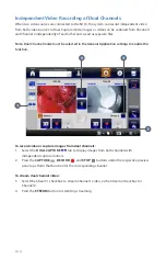 Preview for 24 page of Stryker 0240060100 User Manual