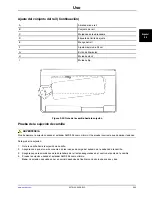 Preview for 63 page of Stryker 6370 Operation Manual