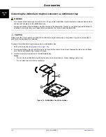 Preview for 24 page of Stryker 747 Operation Manual