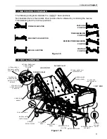 Preview for 11 page of Stryker BERTEC GOBED PLUS FL20E Operation Manual