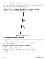 Preview for 160 page of Stryker Gynnie 1061 Operation Manual