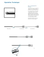 Preview for 12 page of Stryker Hansson Pin System Manual