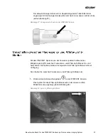 Preview for 201 page of Stryker PINPOINT PC9000 Operator'S Manual