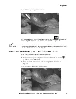 Preview for 633 page of Stryker PINPOINT PC9000 Operator'S Manual