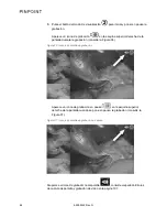 Preview for 1052 page of Stryker PINPOINT PC9000 Operator'S Manual