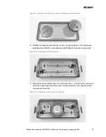 Preview for 1079 page of Stryker PINPOINT PC9000 Operator'S Manual