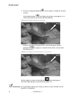 Preview for 1192 page of Stryker PINPOINT PC9000 Operator'S Manual