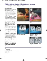 Preview for 7 page of Stryker Scorpio TS Manual