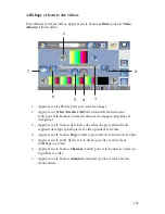 Preview for 113 page of Stryker SDC Ultra User Manual