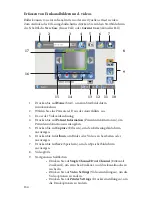 Preview for 170 page of Stryker SDC Ultra User Manual