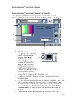 Preview for 177 page of Stryker SDC Ultra User Manual