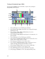 Preview for 746 page of Stryker SDC Ultra User Manual