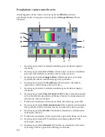 Preview for 820 page of Stryker SDC Ultra User Manual