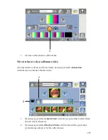 Preview for 823 page of Stryker SDC Ultra User Manual