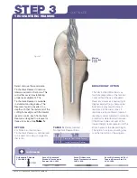 Preview for 8 page of Stryker SECUR-FIT ADVANCED Surgical Technique