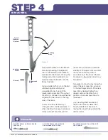 Preview for 10 page of Stryker SECUR-FIT ADVANCED Surgical Technique