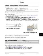 Preview for 889 page of Stryker SV1 Operation Manual