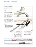 Preview for 27 page of Stryker T2 Operative Technique