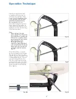 Preview for 31 page of Stryker T2 Operative Technique