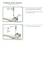 Preview for 10 page of Stryker Triathlon Knee System Surgical Protocol