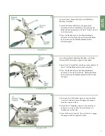 Preview for 11 page of Stryker Triathlon Knee System Surgical Protocol