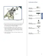 Preview for 21 page of Stryker Triathlon Knee System Surgical Protocol