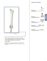 Preview for 23 page of Stryker Triathlon Knee System Surgical Protocol