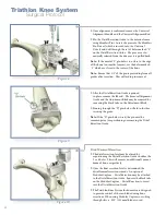 Preview for 24 page of Stryker Triathlon Knee System Surgical Protocol