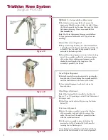 Preview for 38 page of Stryker Triathlon Knee System Surgical Protocol