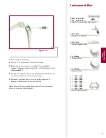 Preview for 43 page of Stryker Triathlon Knee System Surgical Protocol