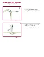 Preview for 44 page of Stryker Triathlon Knee System Surgical Protocol