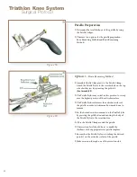 Preview for 48 page of Stryker Triathlon Knee System Surgical Protocol