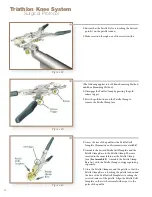 Preview for 50 page of Stryker Triathlon Knee System Surgical Protocol