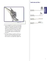 Preview for 13 page of Stryker Triathlon Tritanium Surgical Manualline