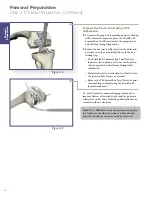 Preview for 20 page of Stryker Triathlon Tritanium Surgical Manualline