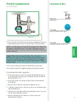 Preview for 45 page of Stryker Triathlon Tritanium Surgical Manualline