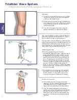 Preview for 8 page of Stryker Triathlon Surgical Manualline