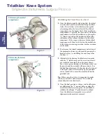 Preview for 10 page of Stryker Triathlon Surgical Manualline