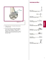 Preview for 15 page of Stryker Triathlon Surgical Manualline