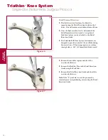 Preview for 16 page of Stryker Triathlon Surgical Manualline