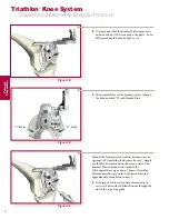 Preview for 18 page of Stryker Triathlon Surgical Manualline