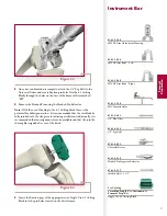 Preview for 19 page of Stryker Triathlon Surgical Manualline