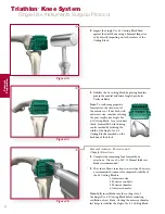 Preview for 20 page of Stryker Triathlon Surgical Manualline