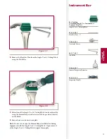 Preview for 21 page of Stryker Triathlon Surgical Manualline