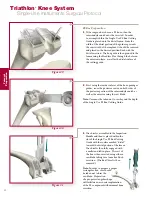 Preview for 22 page of Stryker Triathlon Surgical Manualline