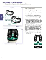 Preview for 26 page of Stryker Triathlon Surgical Manualline