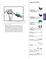 Preview for 27 page of Stryker Triathlon Surgical Manualline