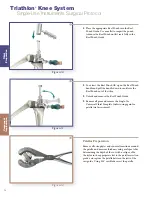 Preview for 28 page of Stryker Triathlon Surgical Manualline