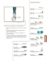 Preview for 31 page of Stryker Triathlon Surgical Manualline